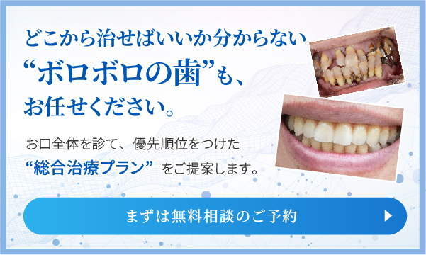 どこから治せばいいか分からないお口もお任せください 総合治療プランのご提案